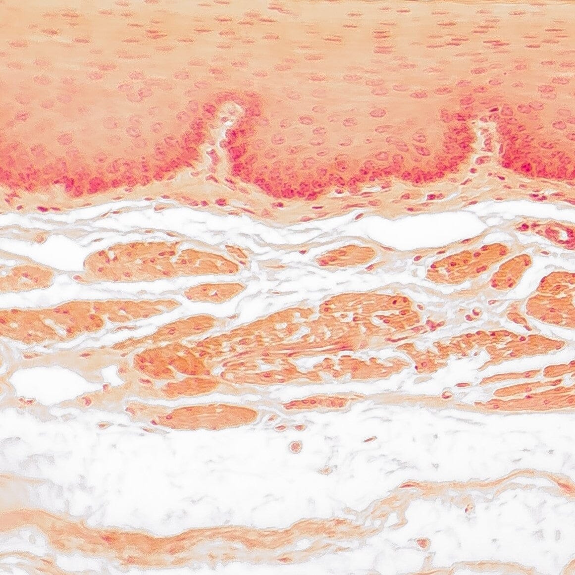 The 3 layers of the skin