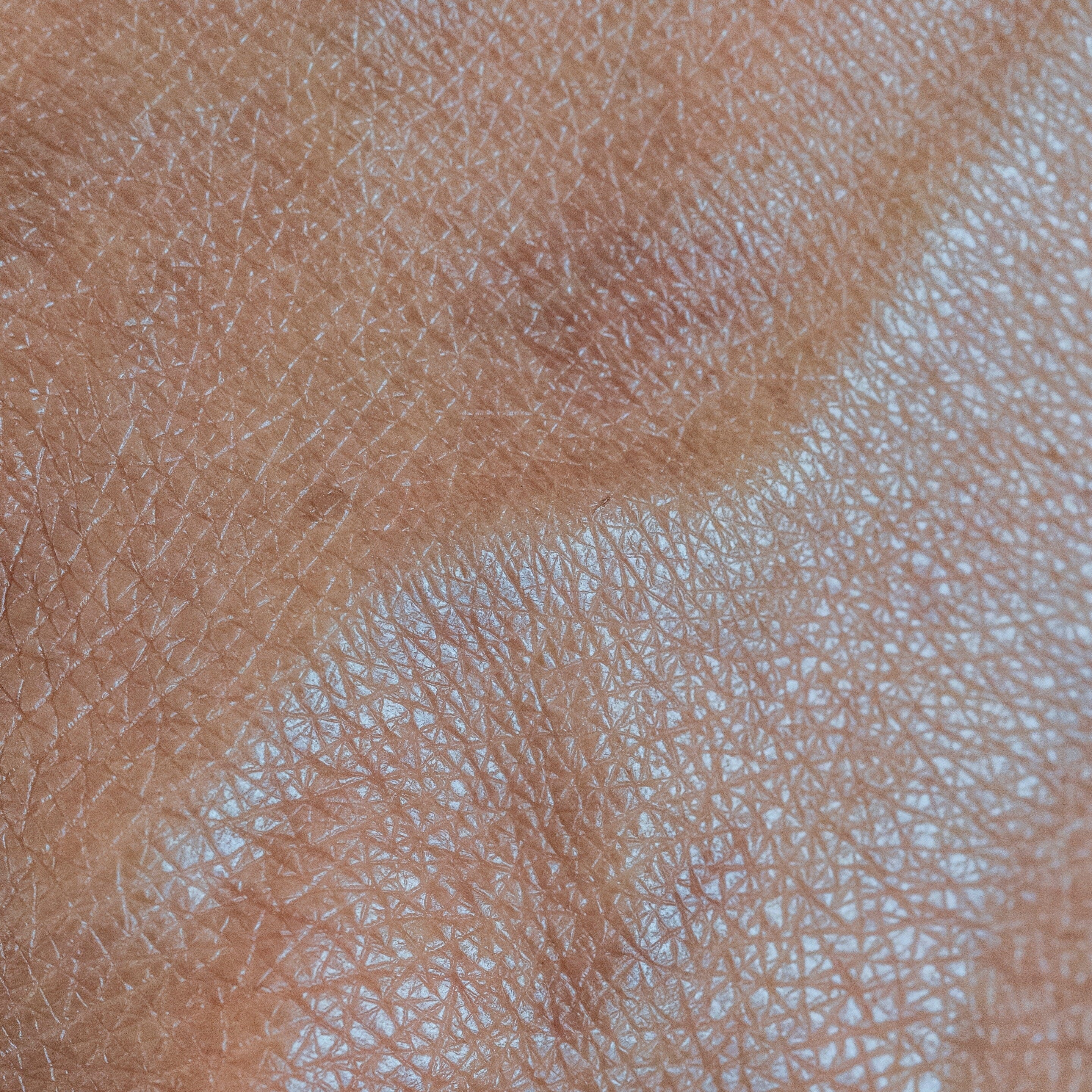 Skin Health
